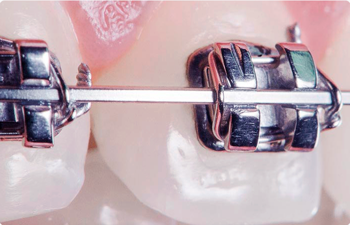 Brackets